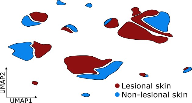 Aberrant lymphoid development drives granuloma formation